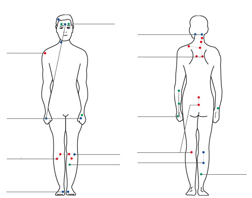 Classic acupuncture points, so-called "meridians" where acupuncture is applied.